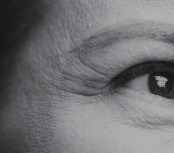 Botox Treatment Netherlands