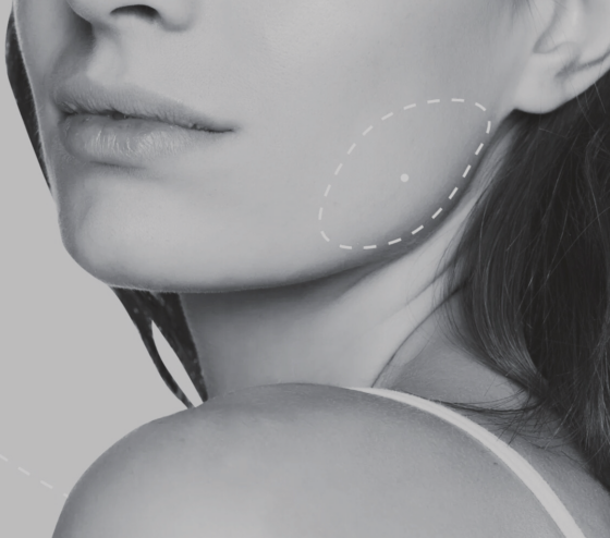 Botox Behandelingen Amsterdam