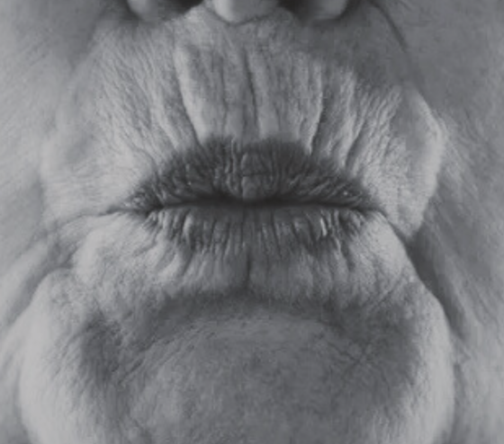 Botox Behandelingen Amsterdam