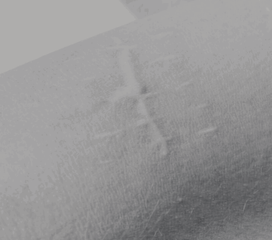 Kopie van botox post templates 31