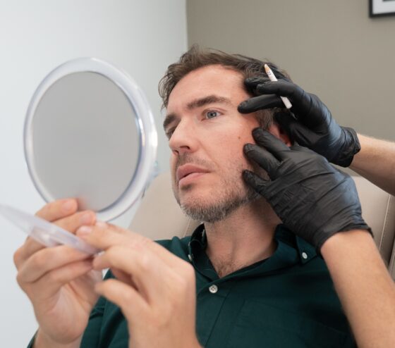 Botox Treatment Netherlands