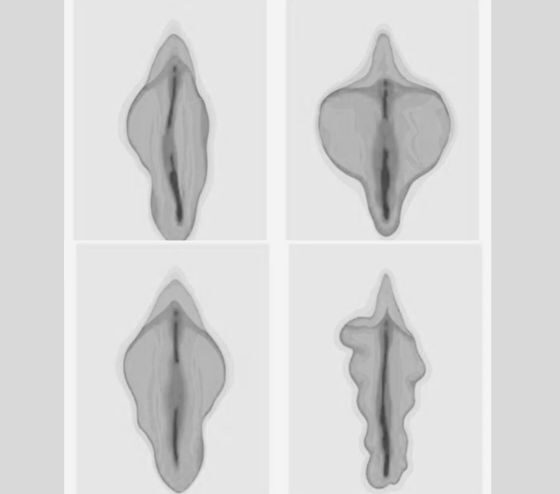 Intieme zone behandeling in kliniek van dokter Brandt