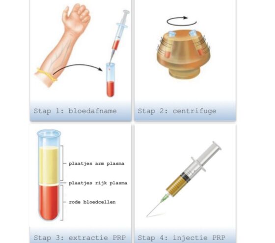 prp prf kliniek dokter brandt 