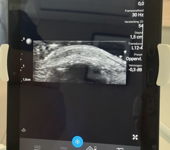 ultrasound 